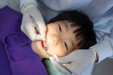 Doktor Dişçi 'nin eli, Asyalı küçük bir çocuğun dişleri üzerinde çalışıyor. 6 yaşındaki hasta diş hekiminde.