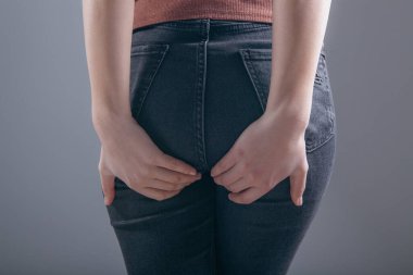woman holding ass. hemorrhoids concept
