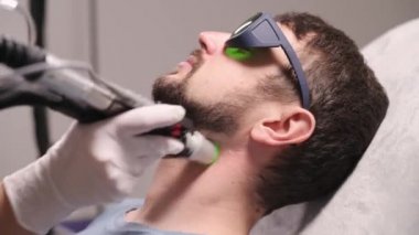 Laser tüy dökücü sakal çevresi..