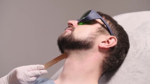 Laser-Enthaarung der Bartkontur. — Stockvideo
