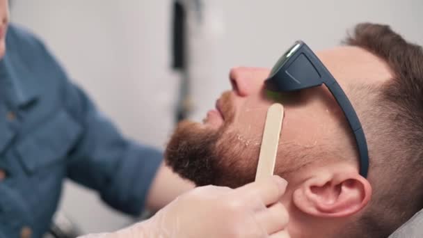 胡子轮廓的激光脱毛 专业美容师将脱毛凝胶应用于人的面部 — 图库视频影像