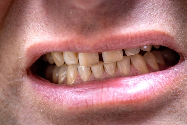 Mężczyzna Pokazuje Swoje Zęby Makro Zbliżenie — Zdjęcie stockowe
