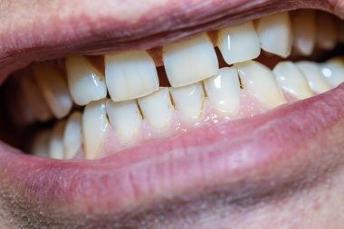 Adam dişlerini gösteriyor, makro yakın plan. 