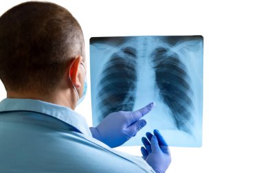 Doktor göğüs ve kaburga röntgenlerini inceliyor ve sağlık sorunları gösteriyor. Beyaz arkaplanda izole edilmiş model, yakın plan.