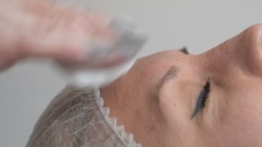 Facial injection procedure. Plastic surgery. Blockage of facial muscles. Wrinkle smoothing by injection. Facial rejuvenation procedure.