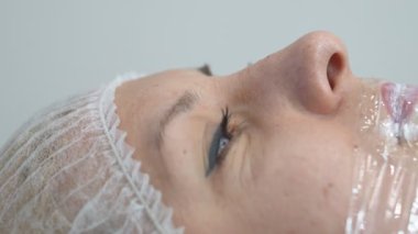 Lip injection procedure. Plastic surgery. Lip contouring procedure. Filler injection for lip augmentation. The process of creating aesthetically beautiful lips.