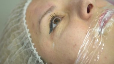 Lip injection procedure. Plastic surgery. Lip contouring procedure. Filler injection for lip augmentation. The process of creating aesthetically beautiful lips.