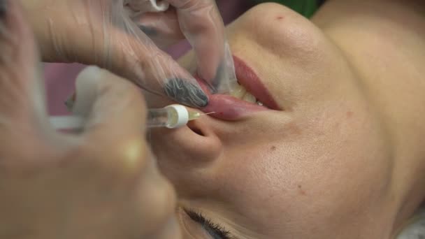 Lip Injection Procedure Plastic Surgery Lip Contouring Procedure Filler Injection — Stockvideo