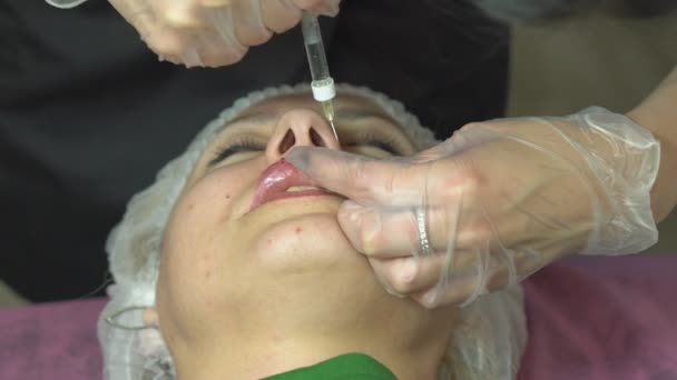 Lip Injection Procedure Plastic Surgery Lip Contouring Procedure Filler Injection — Vídeo de stock