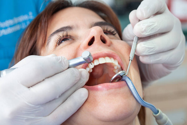 Closeup of a dental instruments being used by the dentist during a dental treatment for a beautiful woman.
