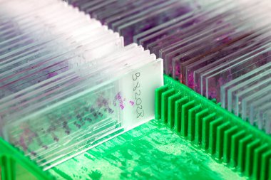 Bir kutu boyalı doku biyopsi camı patoloji laboratuvarında kayıyor.