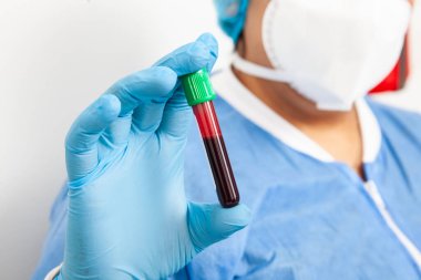 Kan örneği olan bir test tüpünün yakınlaştırılması klinik laboratuarında bir kadın tarafından tutuluyor.