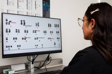 Computer screen showing a human karyotype. Young female scientist making a karyotype in the laboratory clipart