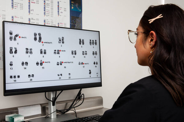 Computer screen showing a human karyotype. Young female scientist making a karyotype in the laboratory