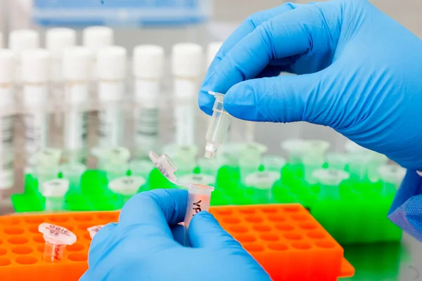 Fechar Mãos Cientista Extrair Dna Usando Técnica Purificação Ácido Nucleico — Fotografia de Stock
