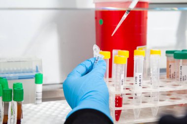 Bilim adamı laminar hava akışı dolabında karyotipe ve floresans için kan örnekleri hazırlıyor. Teşhis için kan örneği hazırlığı. Kan testi.