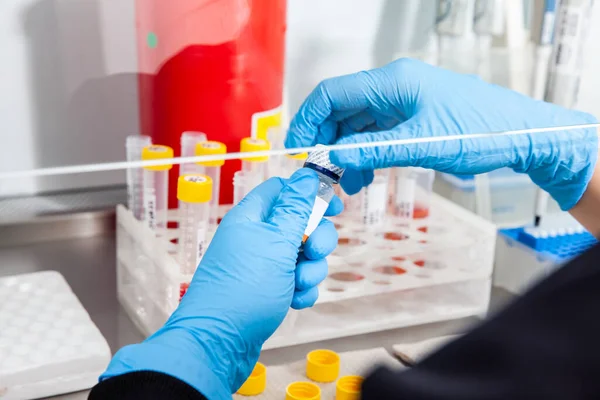 Cientista Preparando Amostras Sangue Para Karyotipe Fluorescência Situ Hibridização Armário — Fotografia de Stock
