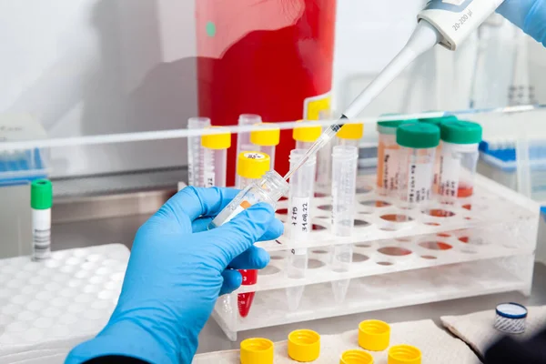 Cientista Preparando Amostras Sangue Para Karyotipe Fluorescência Situ Hibridização Armário — Fotografia de Stock