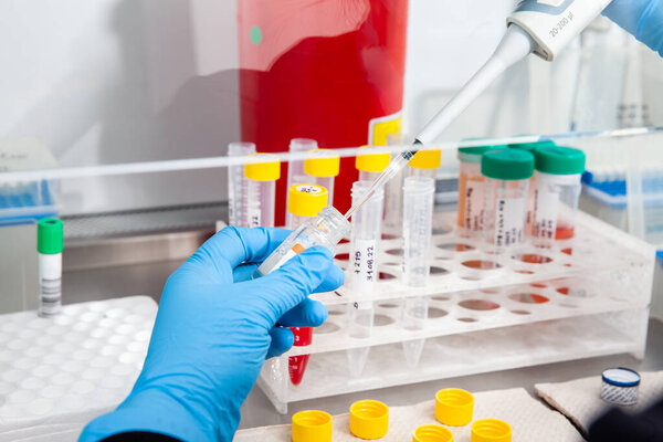 Scientist preparing blood samples for karyotipe and fluorescence in situ hybridization in the  laminar air flow cabinet. Blood sample preparation for diagnosis. Blood test.