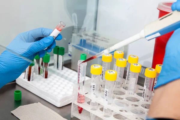 Científico Preparando Muestras Sangre Para Cariotipo Fluorescencia Hibridación Situ Gabinete —  Fotos de Stock