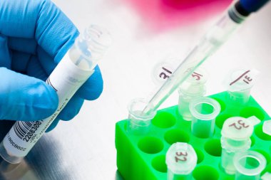Dönme sütun bazlı nükleik asit arıtma tekniğini kullanan bir bilim adamının DNA 'sını çıkarması. Döner sütun bazlı nükleik asit arıtma tekniği. İnsan papillomavirüs enfeksiyonu teşhisi