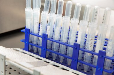 Hasta örnekleri laboratuvarda karyotip ve florasan için slayt hazırlamaya hazır.