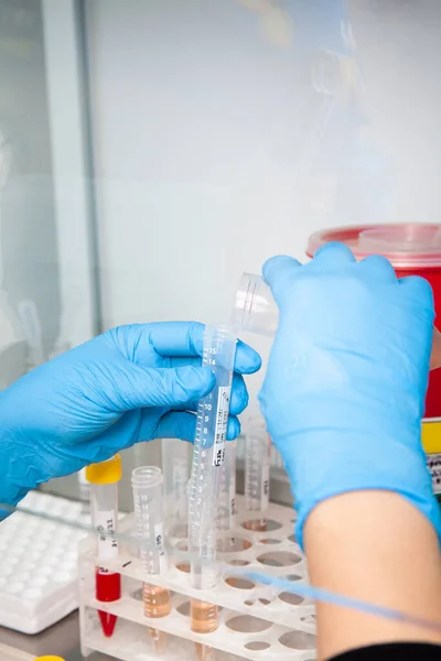 Cientista Preparando Amostras Sangue Para Cariótipo Fluorescência Situ Hibridização Armário — Fotografia de Stock