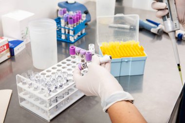Bilim adamı laboratuvarda akış sitometrik analizi için kemik iliği örnekleri hazırlıyor..