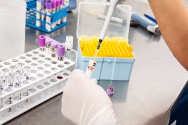 Bilim adamı laboratuvarda akış sitometrik analizi için kemik iliği örnekleri hazırlıyor..