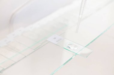 Bilimadamları laboratuvarda immünohistokimya testi için parafin yerleştirilmiş doku örnekleri hazırlıyorlar..