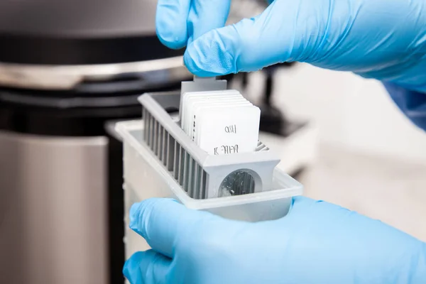 Scientist preparing slides with tissue samples for immunohistochemistry assay in the laboratory. Scientist at the Immunohistochemistry laboratory carry out antigen retrieval on microscope slides with biopsy tissue.