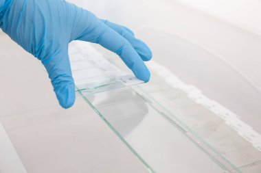 Bilimadamları laboratuvarda immünohistokimya testi için parafin yerleştirilmiş doku örnekleri hazırlıyorlar..