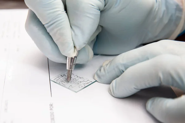 Laboratorian labelling a microscope slide using a diamond tip pencil. Laboratorian giving admission to pap smear samples in the laboratory for analysis.