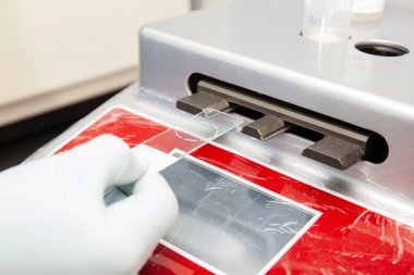 Bilim adamı pap smear testi için sıvı bazlı sitoloji metoduyla mikroskop slaytları hazırlıyor. Rahim kanseri konsepti. Tıbbi konsept.