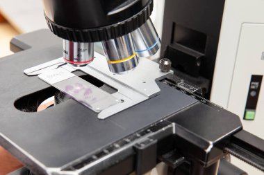 Mikroskop altında lekeli doku biyopsisi yapılan mikroskoba yakın çekim. Kanser tanısı konsepti. Tıbbi konsept.