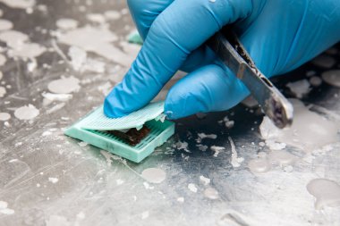 Biyopsi örneği içeren kaset. Bilim adamı parafin bloklara dokular yerleştiriyor. Patoloji laboratuarı. Kanser teşhisi.