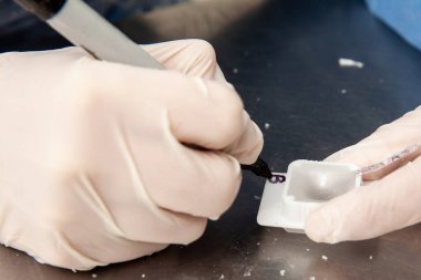 Bilim adamı biyopsi dokusu içeren parafin blokları hazırlıyor. Patoloji laboratuarı. Kanser teşhisi.