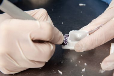 Bilim adamı biyopsi dokusu içeren parafin blokları hazırlıyor. Patoloji laboratuarı. Kanser teşhisi.