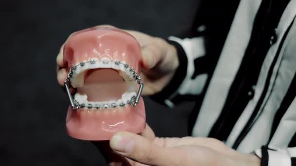 De tandarts houdt een kunstgebit kaak met orthodontische beugels op zijn tanden. Demonstratie van orthodontisten en beugels op het model. — Stockvideo