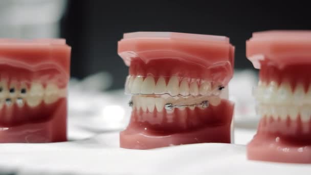 Modelo do gap dentário na colocação de braquetes ortodônticos. Variantes de colocação e fixação de ortodontistas em diferentes layouts. Anomalia dentária — Vídeo de Stock