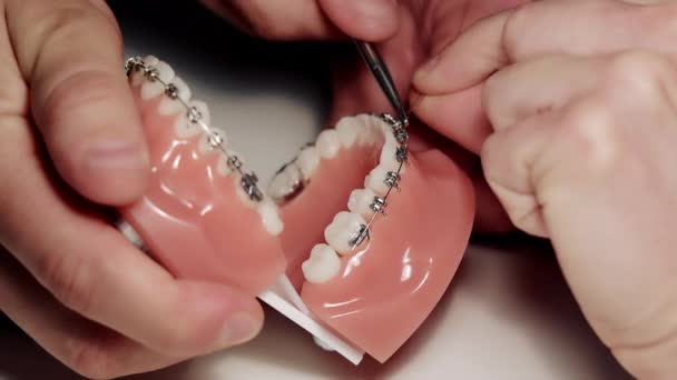 Instalación de ortodoncistas. El dentista demuestra la instalación de aparatos ortopédicos en el modelo dental. El dentista mide la distancia de los aparatos ortodóncicos. — Vídeos de Stock