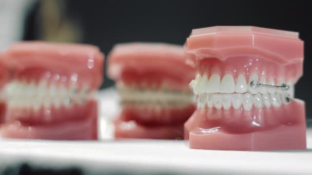Modelo del hueco dental en la colocación de soportes ortodóncicos. Variantes de colocación y fijación de ortodoncistas en diferentes diseños. Anomalía dental — Vídeos de Stock