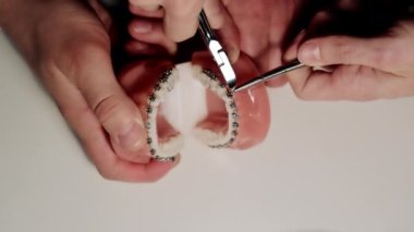 Ortodontistlerin yerleştirilmesi. Diş hekimi diş modelinde diş teli kurulumunu gösterir. Dişçi ortodonti tellerinin uzaklığını ölçer..