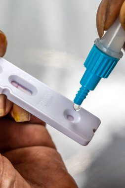 Covid-19-ANTIGENIC NASAL SELF-TEST Nasal sample