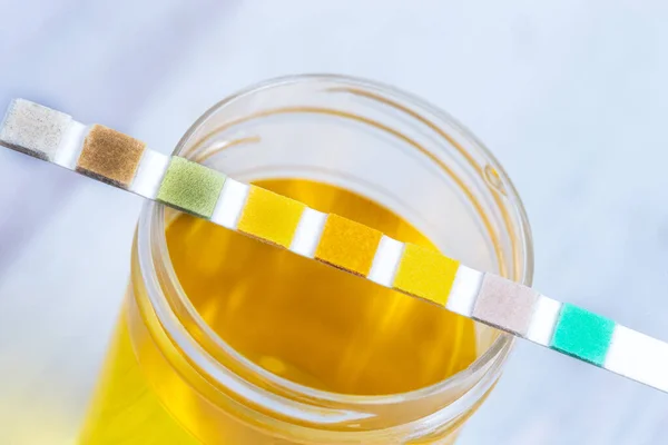 Gambar konseptual pada analisis urin, dipstick ditempatkan pada botol urin — Stok Foto
