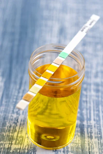 Konceptuell bild på urinanalys, mätsticka placerat på injektionsflaskorna med urin — Stockfoto