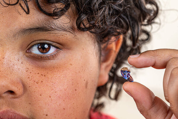 Крупный план протеза, установленного на подростка.