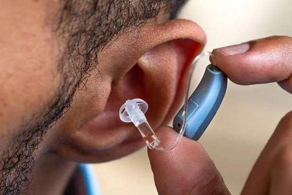 Close Placement Prosthesis Ear Young Man — Stock Photo, Image