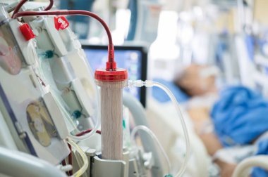 Uzmanlar yoğun bakım ünitelerindeki kritik hastalarda kullanmak üzere bir diyaliz makinesi hazırlıyorlar..