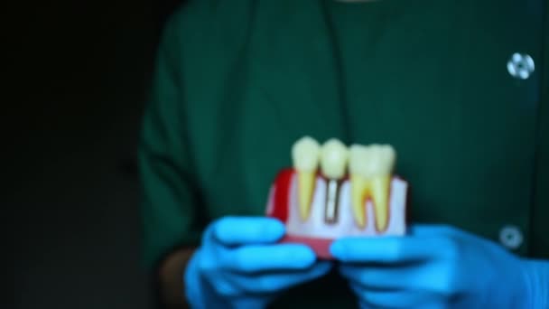 Mplant Dişçiliğinin Yakın Plan Fotoğrafı Dişçiye Ait Olmayan Dişlerin Yerine — Stok video